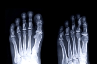 How Bones and Muscles in the Feet Work Together