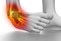 Facts About Ankle Sprains